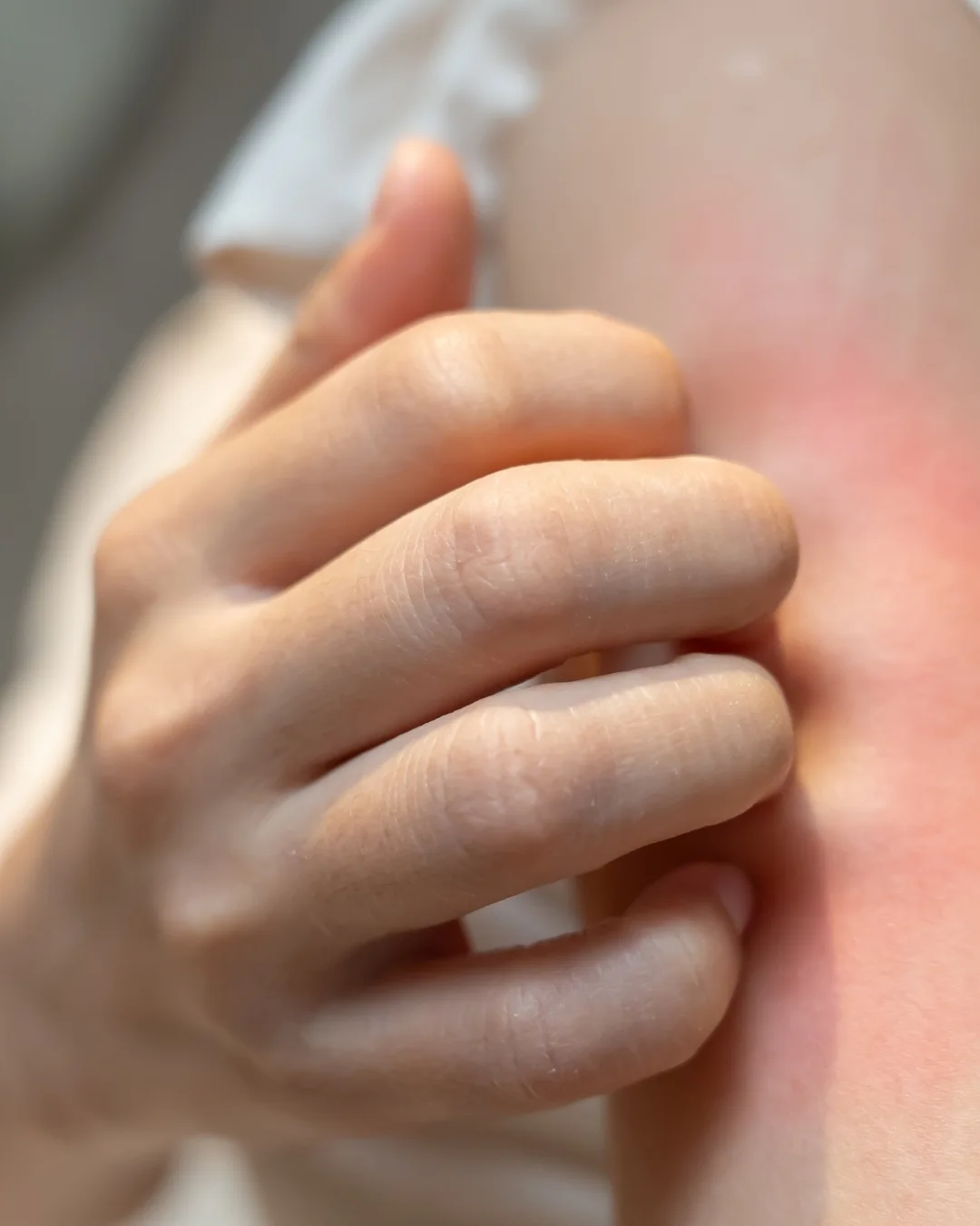 réaction allergique tatouage